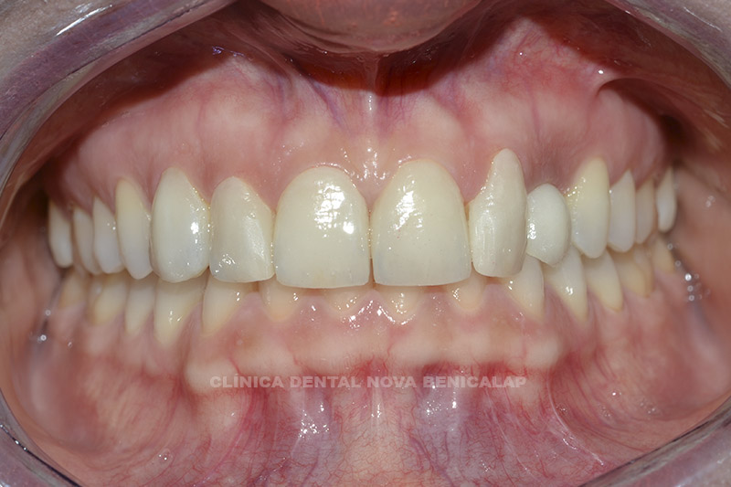 dentista-valencia-2