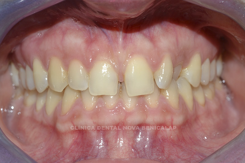 dentista-valencia